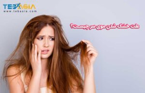 علت خشک شدن موهای سر چیست؟
